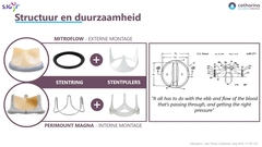 Houthuizen0007