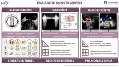 Houthuizen0022