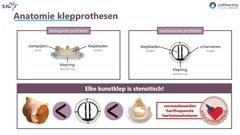 Houthuizen0024