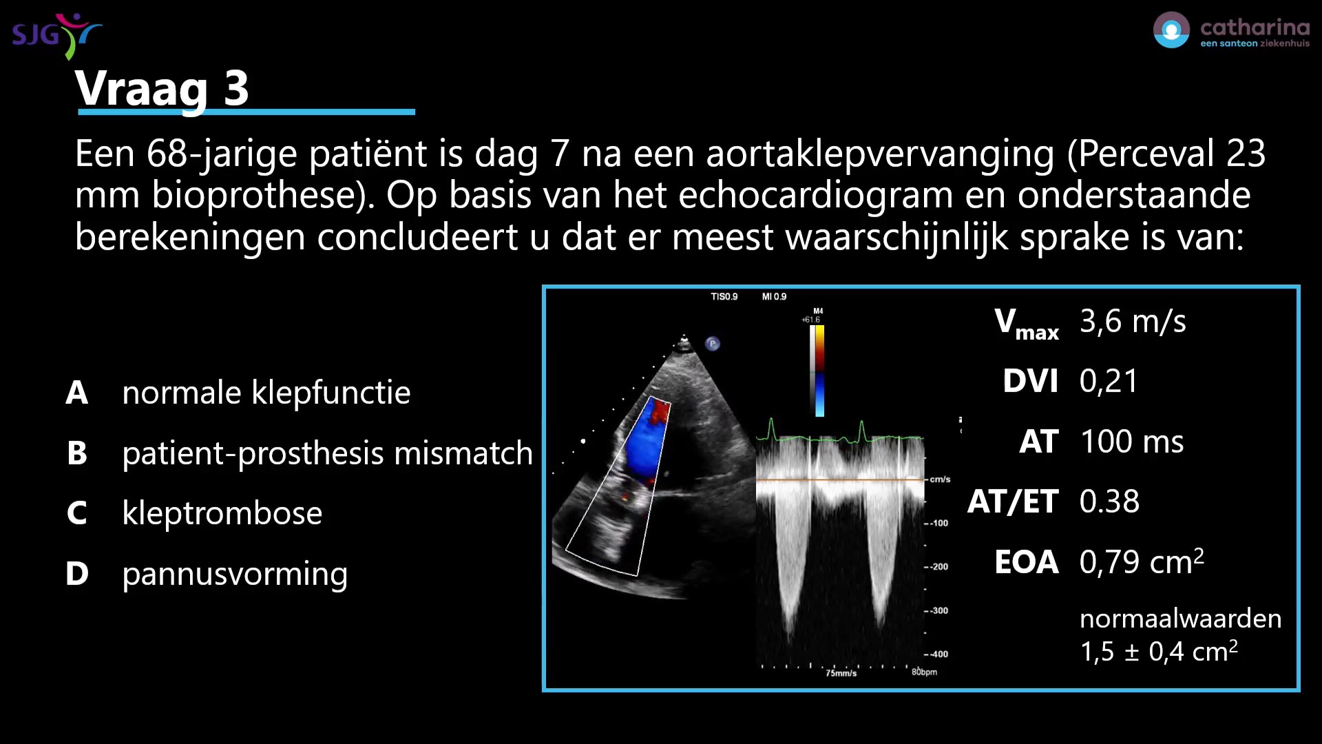 Houthuizen0026